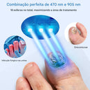 Dispositivo de Laser para Unhas com Fungo – Tratamento Seguro e Indolor em Casa
